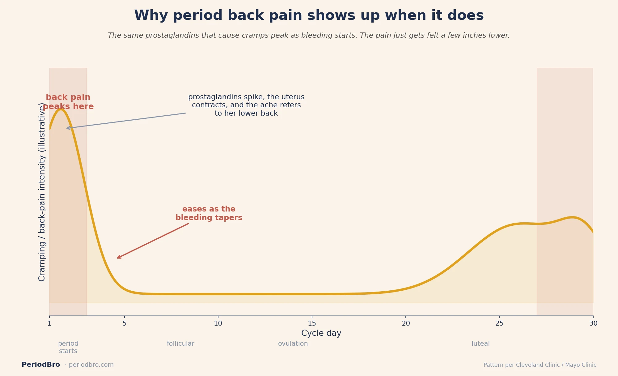 Period back pain window timeline: cramping intensity peaks as bleeding starts