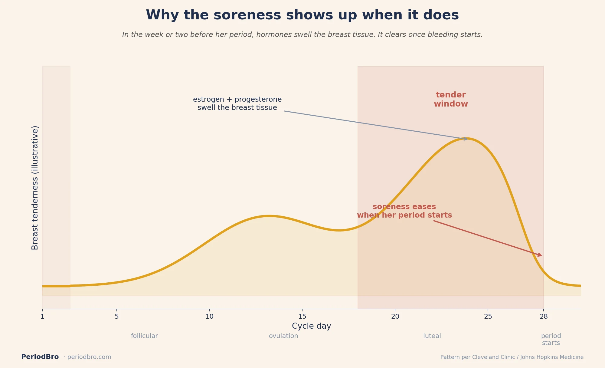 Why sore breasts before her period peak in the luteal phase and ease when her period starts