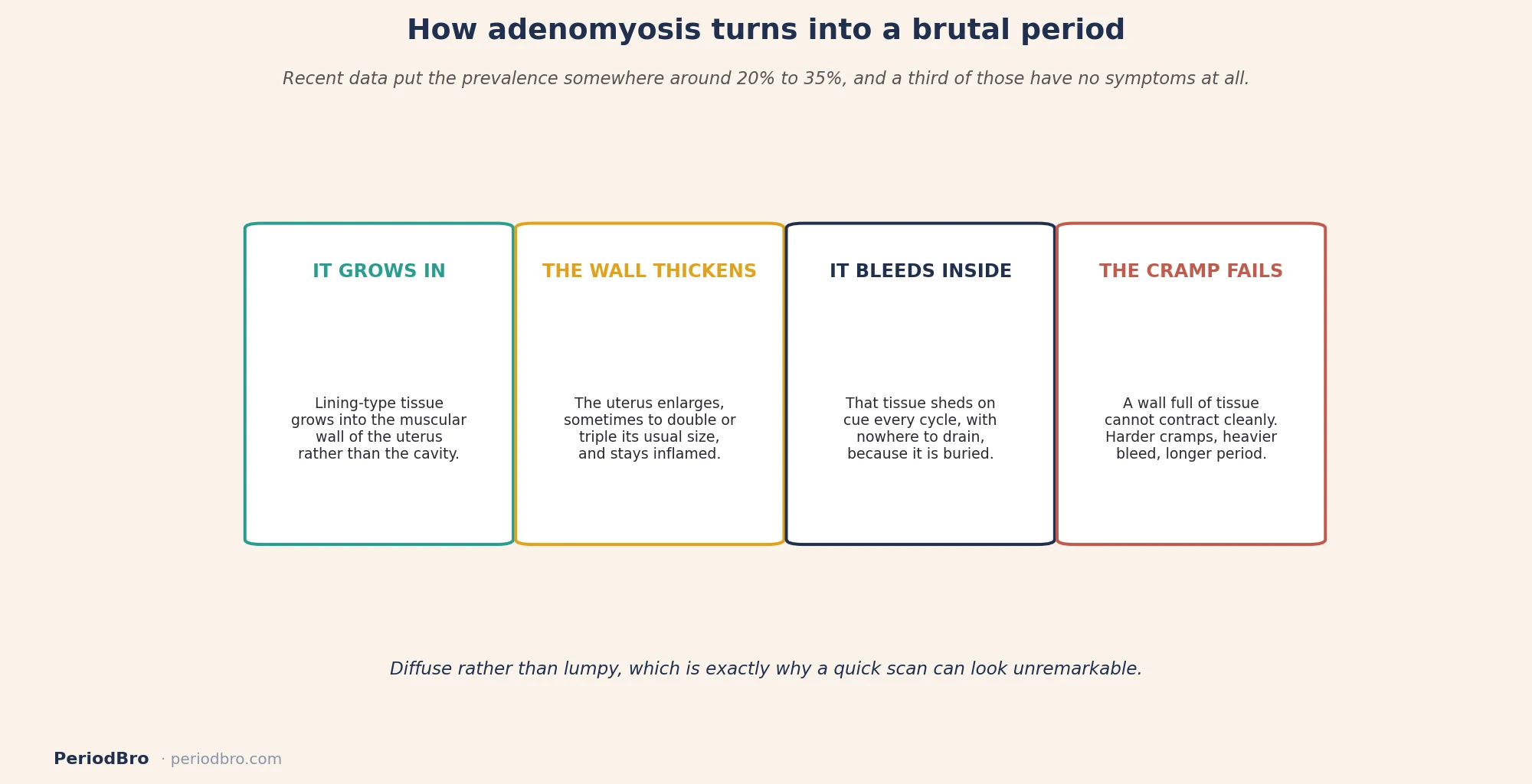 Adenomyosis for partners: how lining tissue in the uterine wall turns into a heavier, more painful period